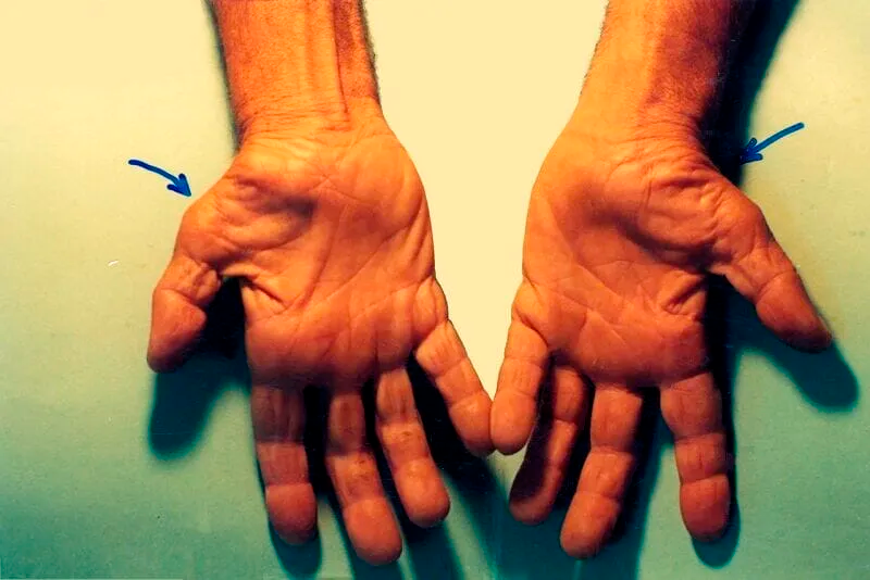 Excelência em Neurofisiologia e Reabilitação Diagnóstico preciso, tecnologia de ponta e cuidado humanizado. AGENDAR EXAME AGORA Especialistas em Saúde Neurológica há 19 anos Na Cliner, unimos inovação e experiência para oferecer diagnósticos neurológicos confiáveis e tratamentos eficazes. Contamos com um time altamente qualificado e equipamentos de última geração para garantir a melhor assistência aos nossos