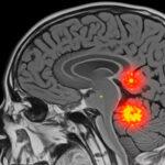 Excelência em Neurofisiologia e Reabilitação Diagnóstico preciso, tecnologia de ponta e cuidado humanizado. AGENDAR EXAME AGORA Especialistas em Saúde Neurológica há 19 anos Na Cliner, unimos inovação e experiência para oferecer diagnósticos neurológicos confiáveis e tratamentos eficazes. Contamos com um time altamente qualificado e equipamentos de última geração para garantir a melhor assistência aos nossos
